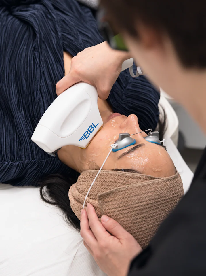 The BBL handpiece firing over a client's cheek beside the console, the practitioner in laser goggles