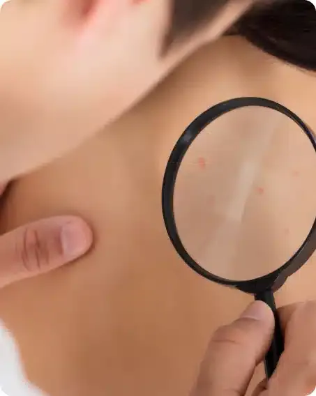 A clinician examining small spots on a patient's neck and upper back through a magnifying glass