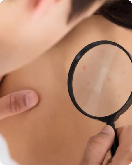 A clinician examining small spots on a patient's neck and upper back through a magnifying glass