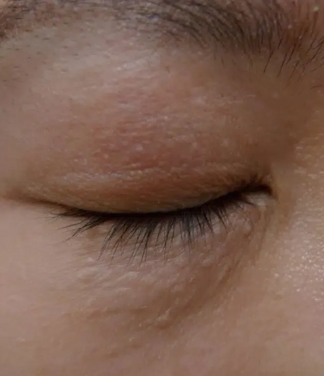 Close view of a closed eye and the delicate skin of the lower eyelid