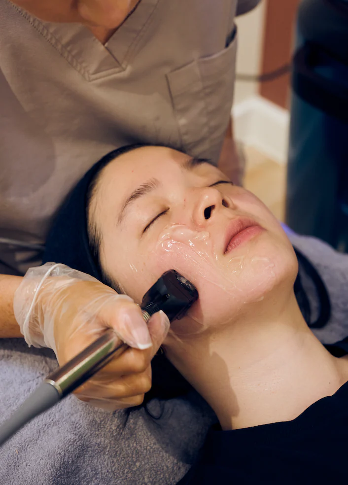 Close view of the InMode applicator being worked across a client's cheek