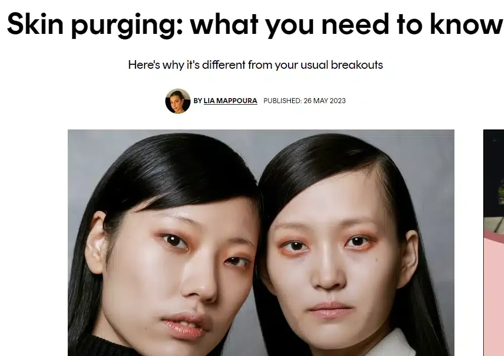 Skin purging: what you need to know -Cosmopolitan excerpt