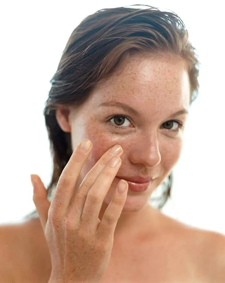 Melasma, Feature, Dr Jinah Yoo