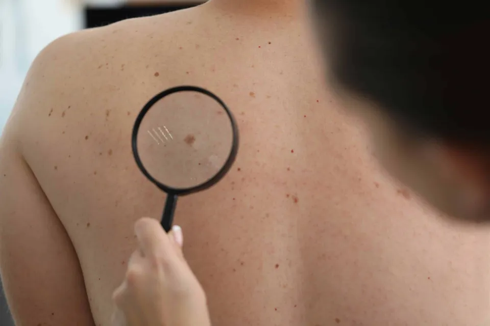 Mole, Dr Jinah Yoo