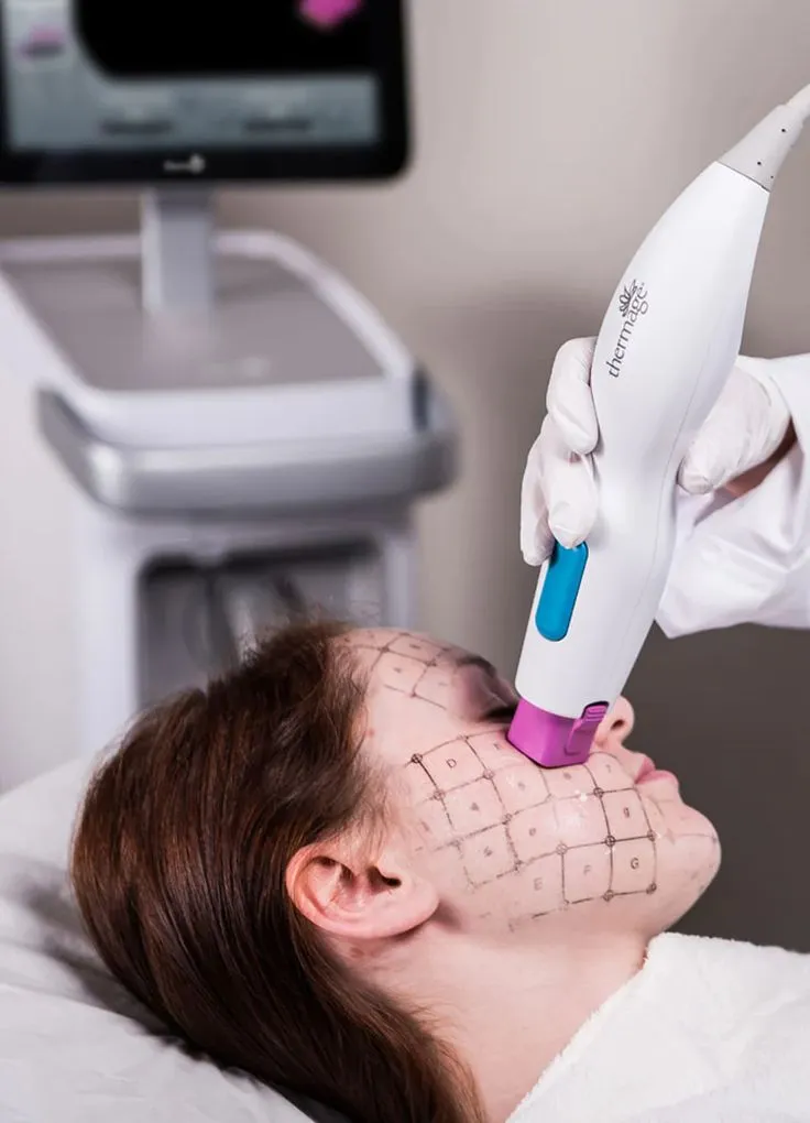 thermage, Dr Jinah Yoo