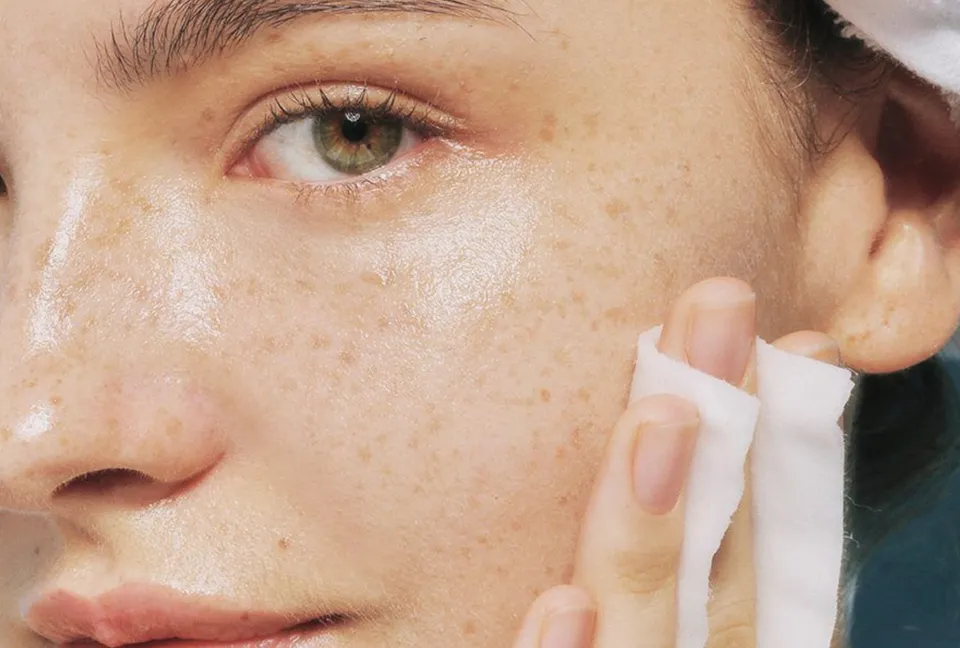 Why Are My Pores So Large Dr Jinah Yoo