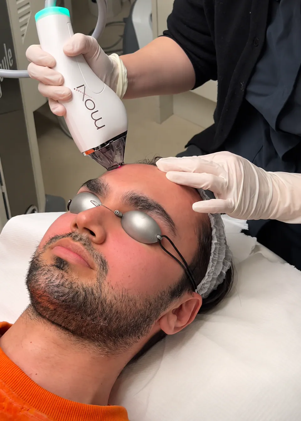 A practitioner passing the Moxi handpiece across a patient's forehead, eyes shielded with laser goggles