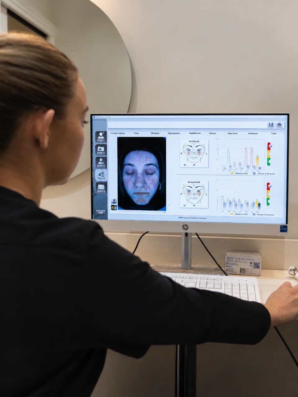 A practitioner reviewing a Mark Vu red and brown analysis on screen, the patient's imaging shown alongside the charts