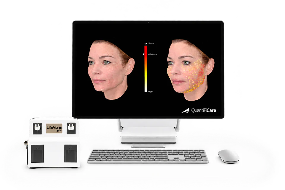 The QuantifiCare 3D imaging system, with LifeViz camera and analysis software on screen