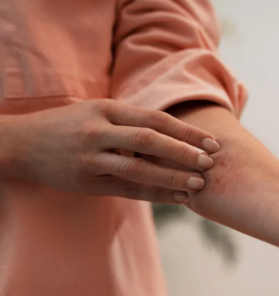 A woman in a peach top scratching an irritated patch of eczema on her forearm