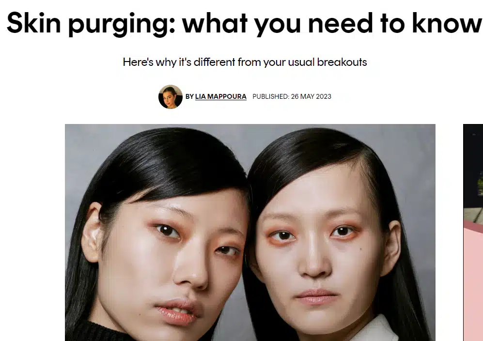 Skin purging: what you need to know -Cosmopolitan excerpt