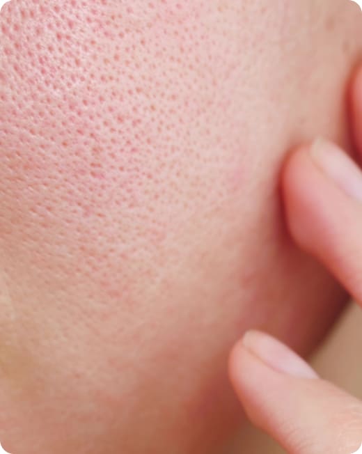 Irritated Skin, Dr Jinah Yoo