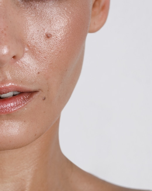 Sebaceous Gland, Dr Jinah Yoo