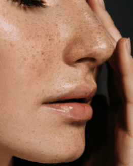 Skin 1 11 11 1, Dr Jinah Yoo