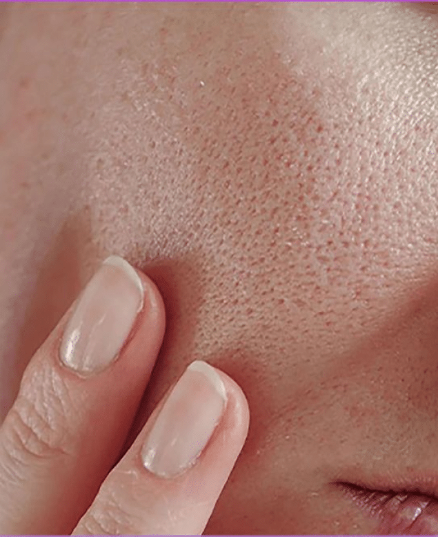 Young Man Skin Texture, Dr Jinah Yoo