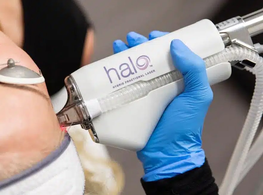 halo laser 1, Dr Jinah Yoo