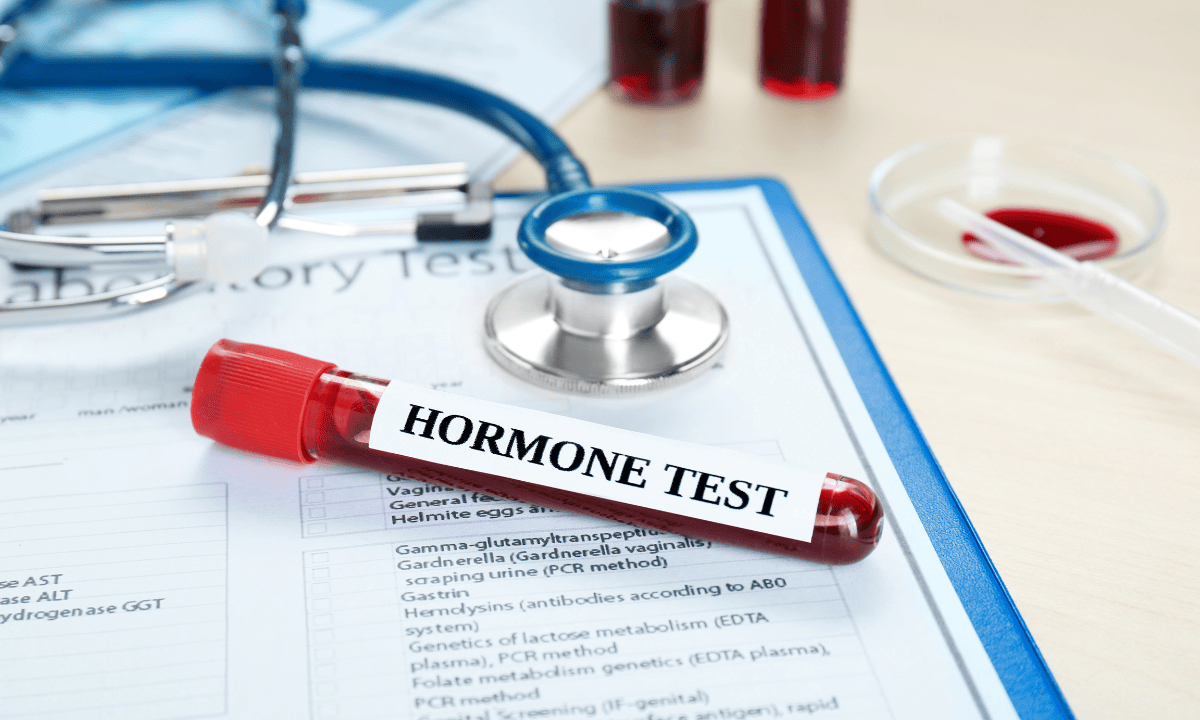 HORMONE TEST1, Dr Jinah Yoo