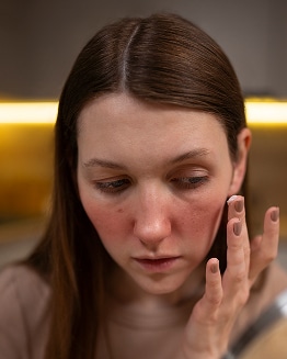 woman using medicine help with rosacea skin condition 1